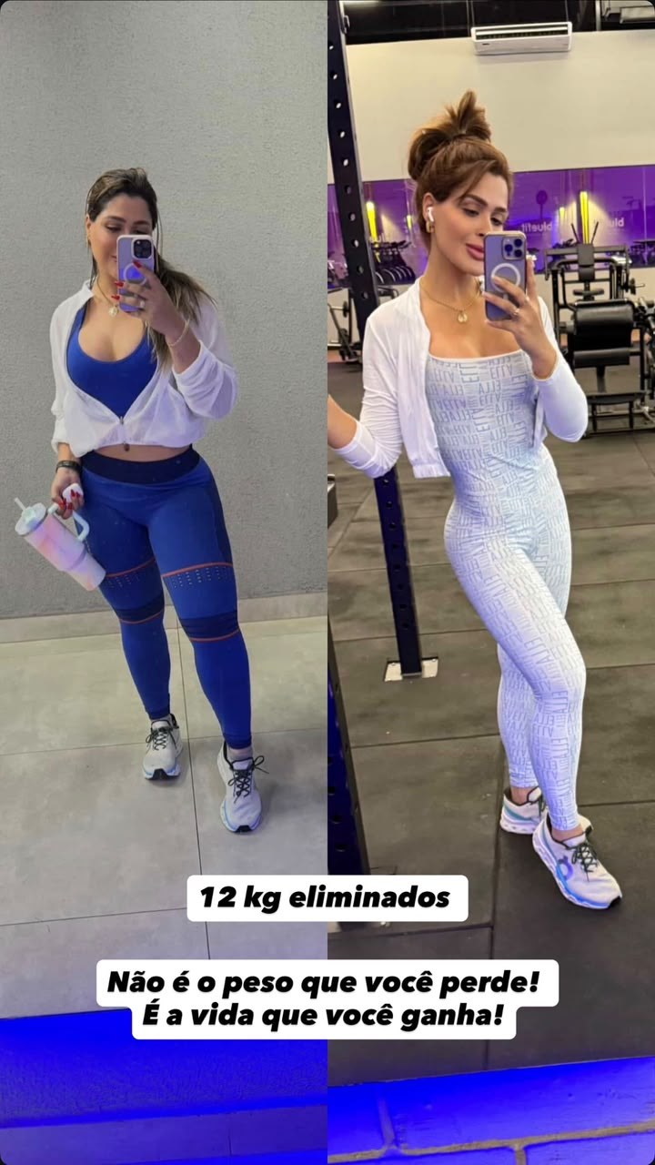 Paciente antes e depois do acompanhamento, com 12 kg eliminados