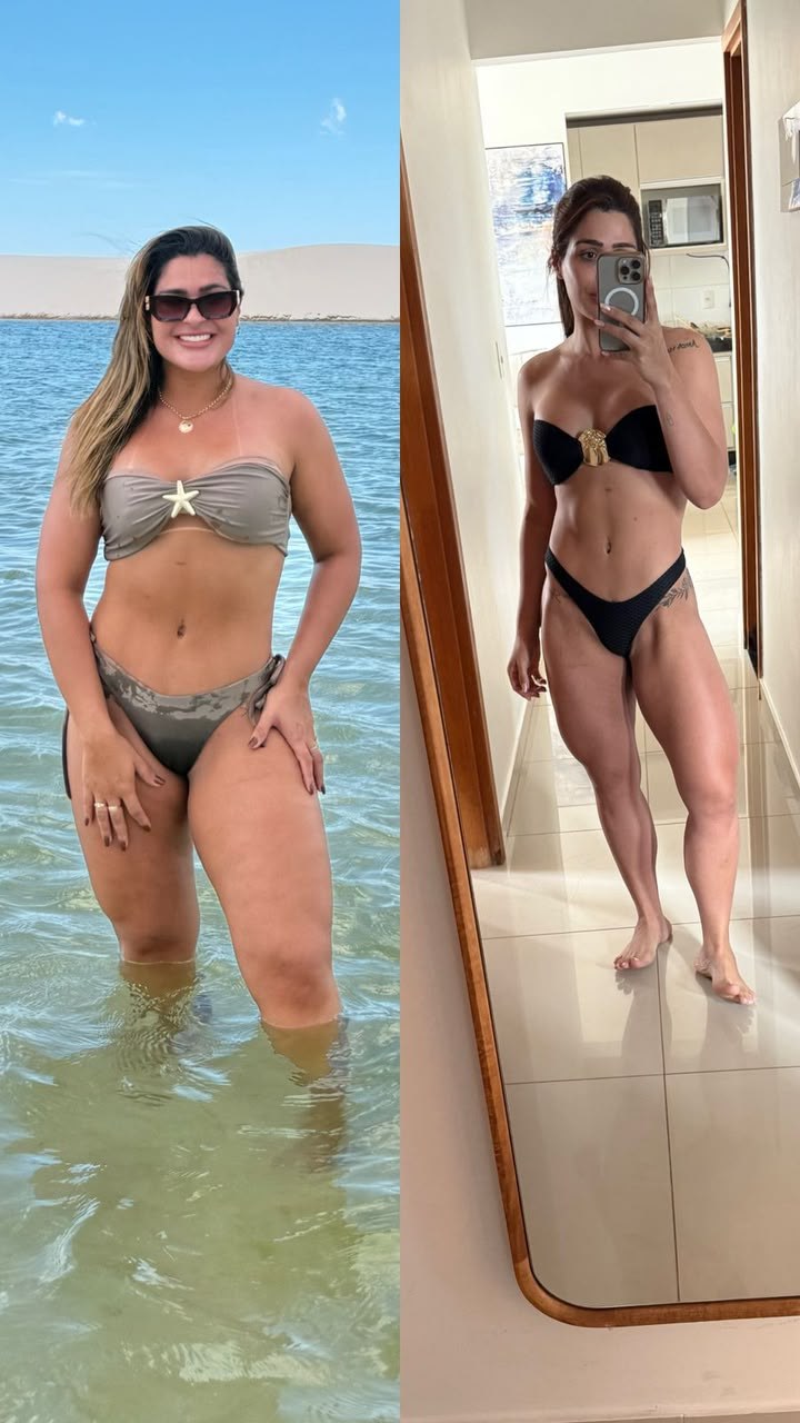 Paciente antes e depois do acompanhamento, em foto na praia e em espelho