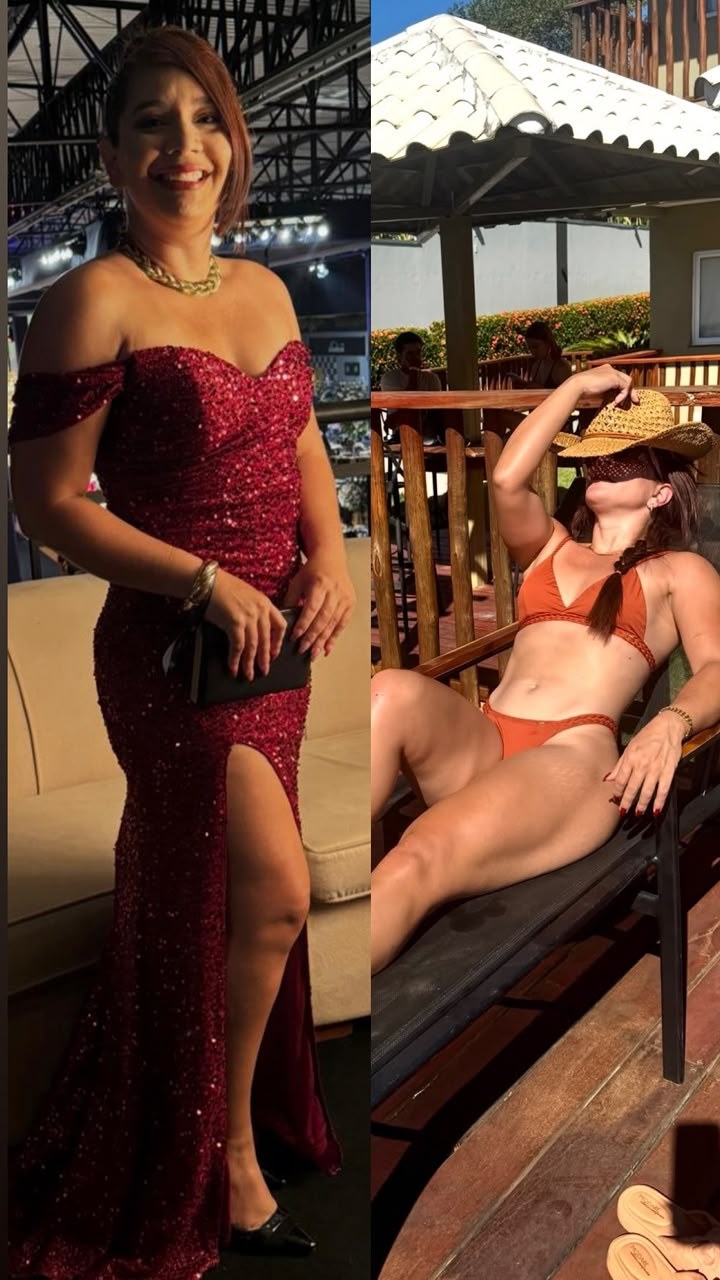 Paciente antes e depois do acompanhamento, em foto de evento e em lazer